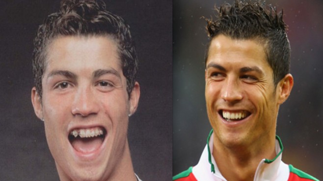 FOTO/ Si kanë ndryshuar yjet e futbollit pas operacioneve plastike